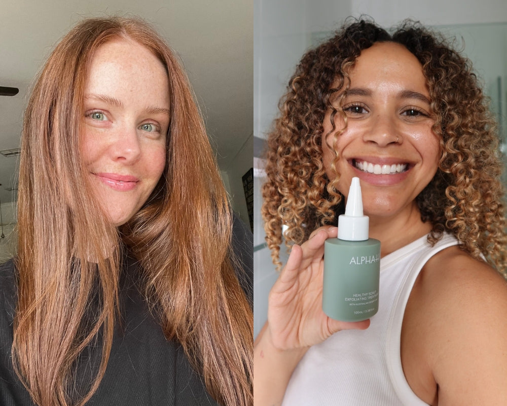 “It changed everything”: 5 people review our first ever hair and scalp product.