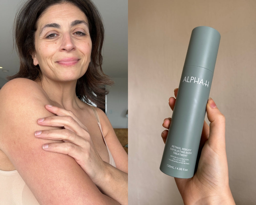 "It’s remarkable”: 6 people review our new Retinol and Glycolic Acid body treatment.
