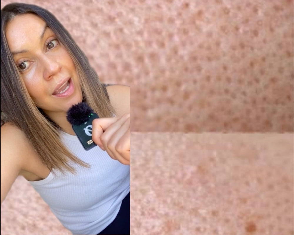 Can You Actually Get Rid of Your Pores? A Skin Expert Shares the Truth