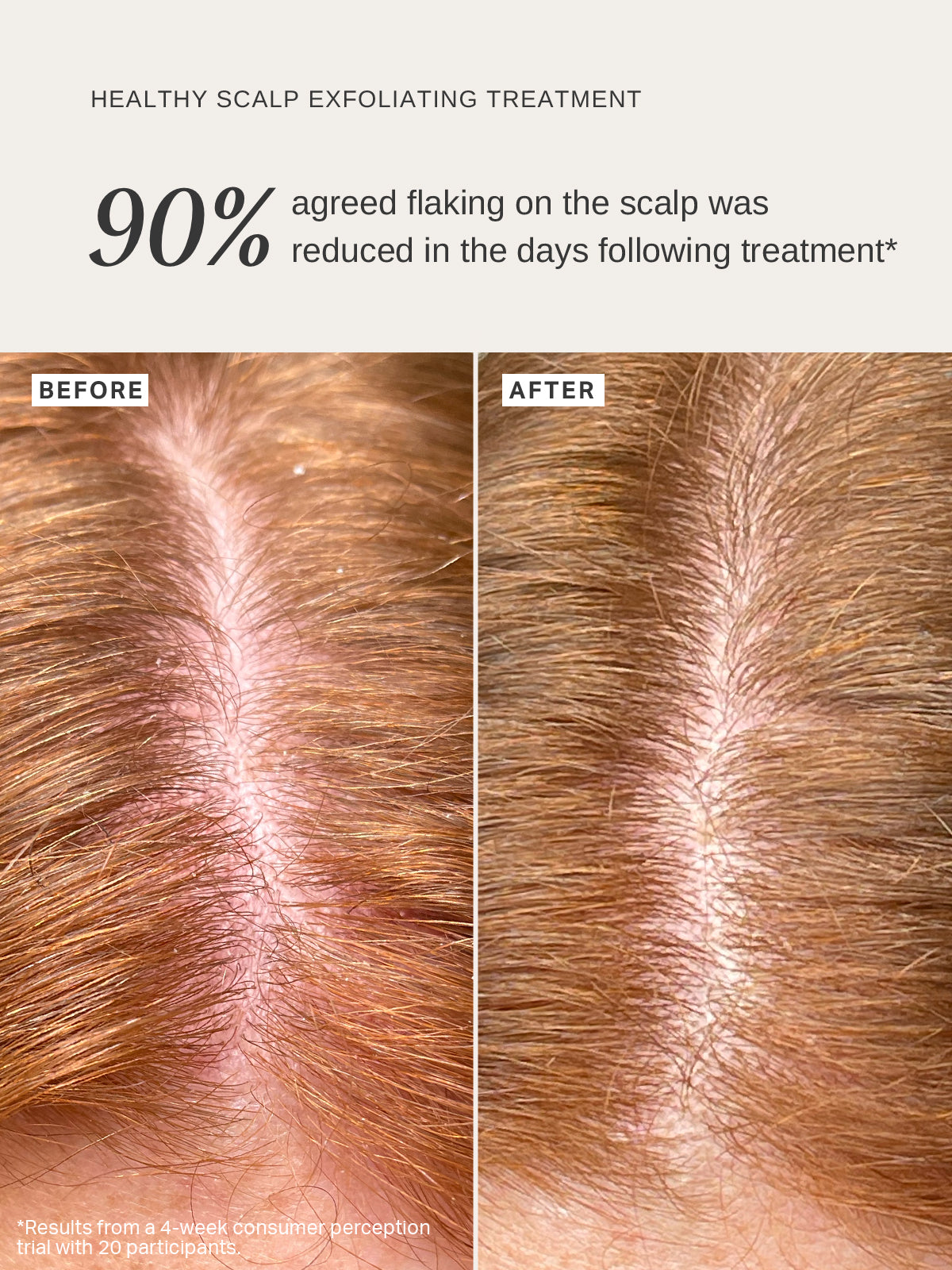 Healthy Scalp Exfoliating Treatment - Alpha-H Skincare Australia