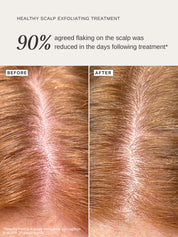 Healthy Scalp Exfoliating Treatment - Alpha-H Skincare Australia