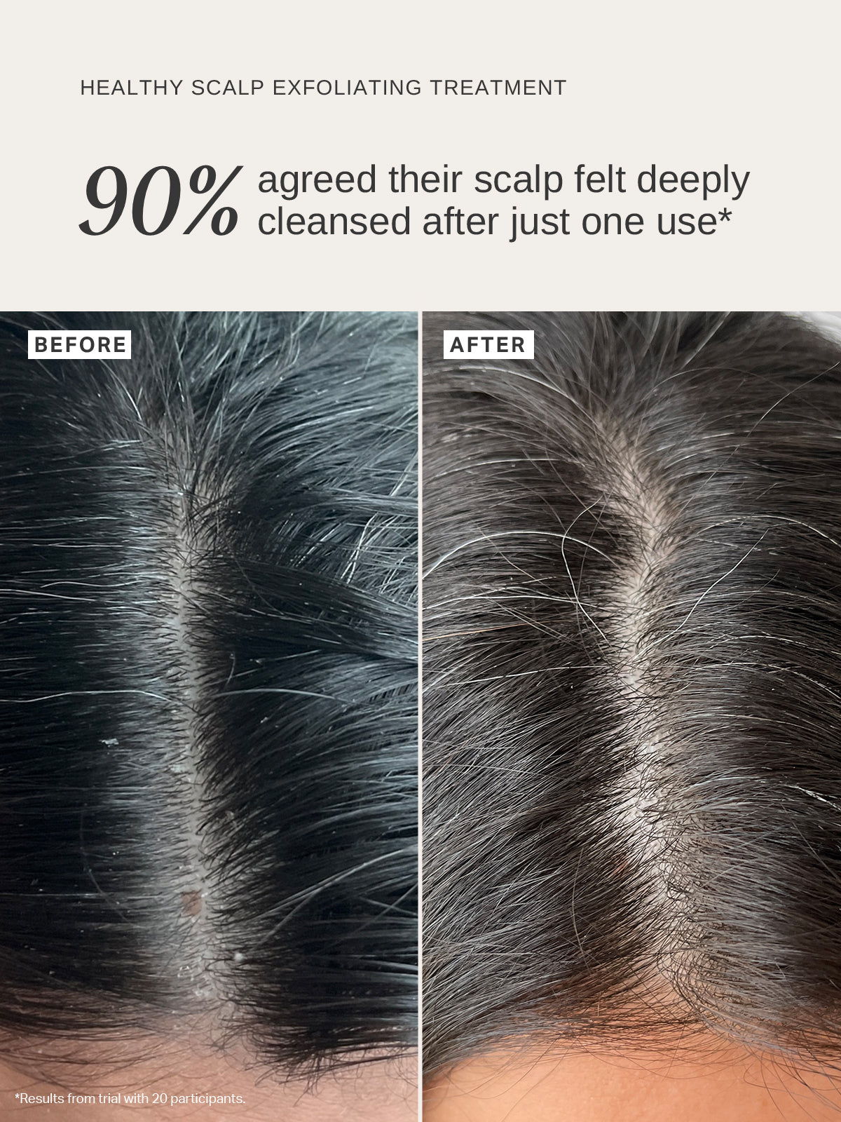 Healthy Scalp Exfoliating Treatment - Alpha-H Skincare Australia