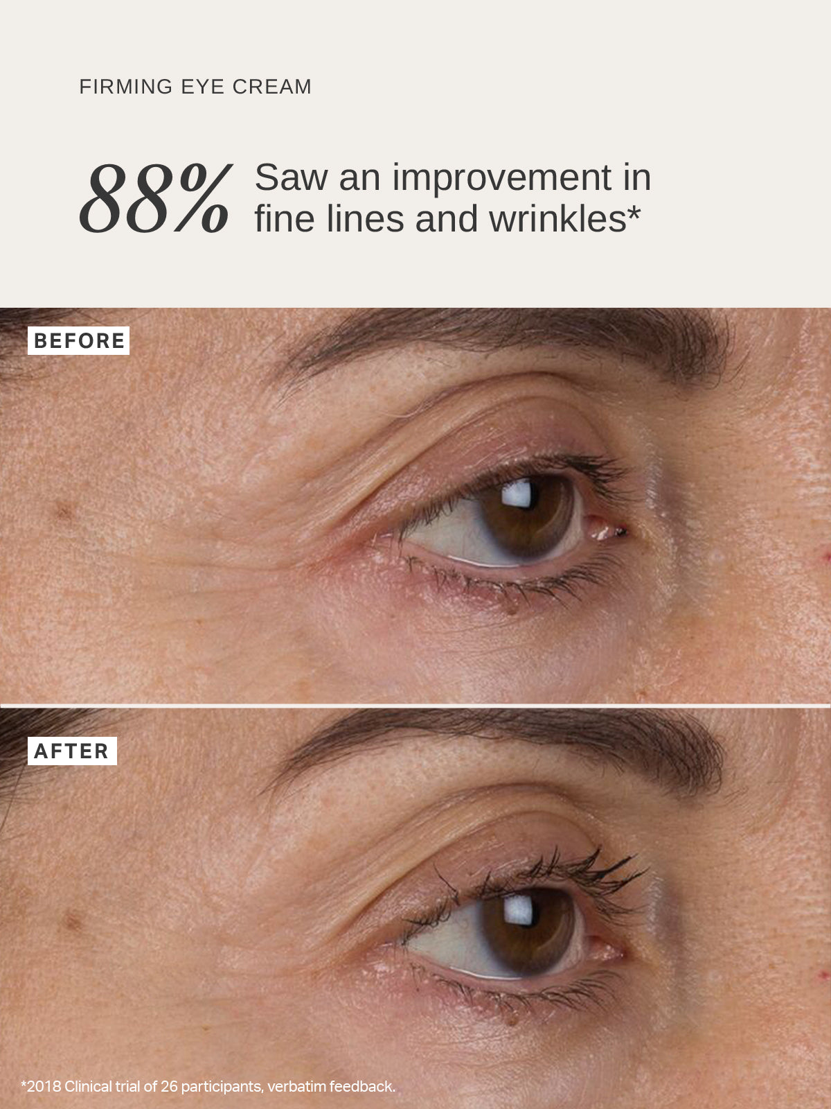 Liquid Gold Firming Eye Cream - Alpha-H Skincare Australia