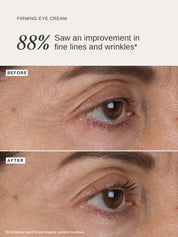 Liquid Gold Firming Eye Cream - Alpha-H Skincare Australia
