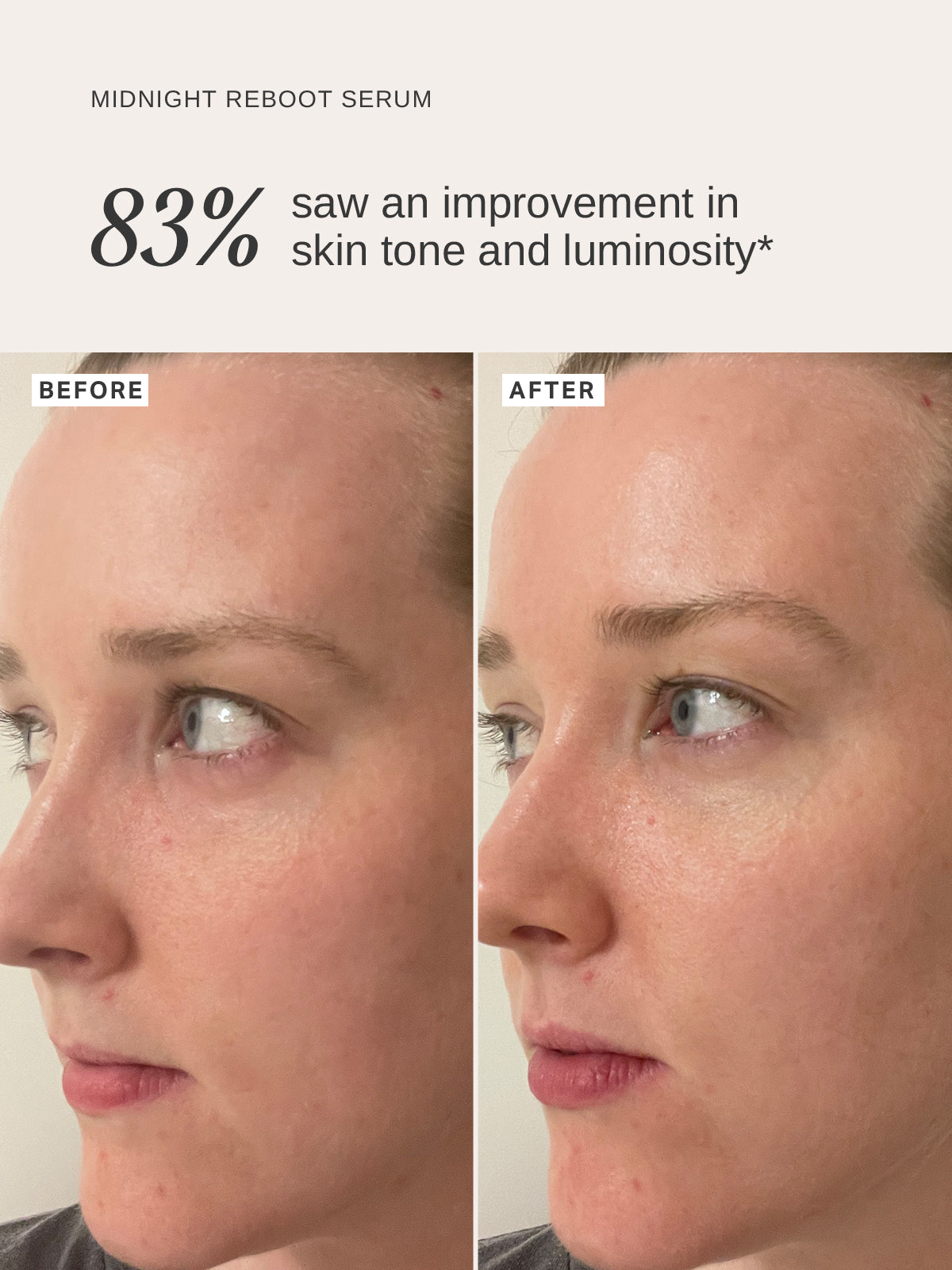 Midnight Reboot Serum (nov 2025) - Alpha-H Skincare Australia