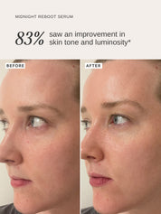 Midnight Reboot Serum (nov 2025) - Alpha-H Skincare Australia