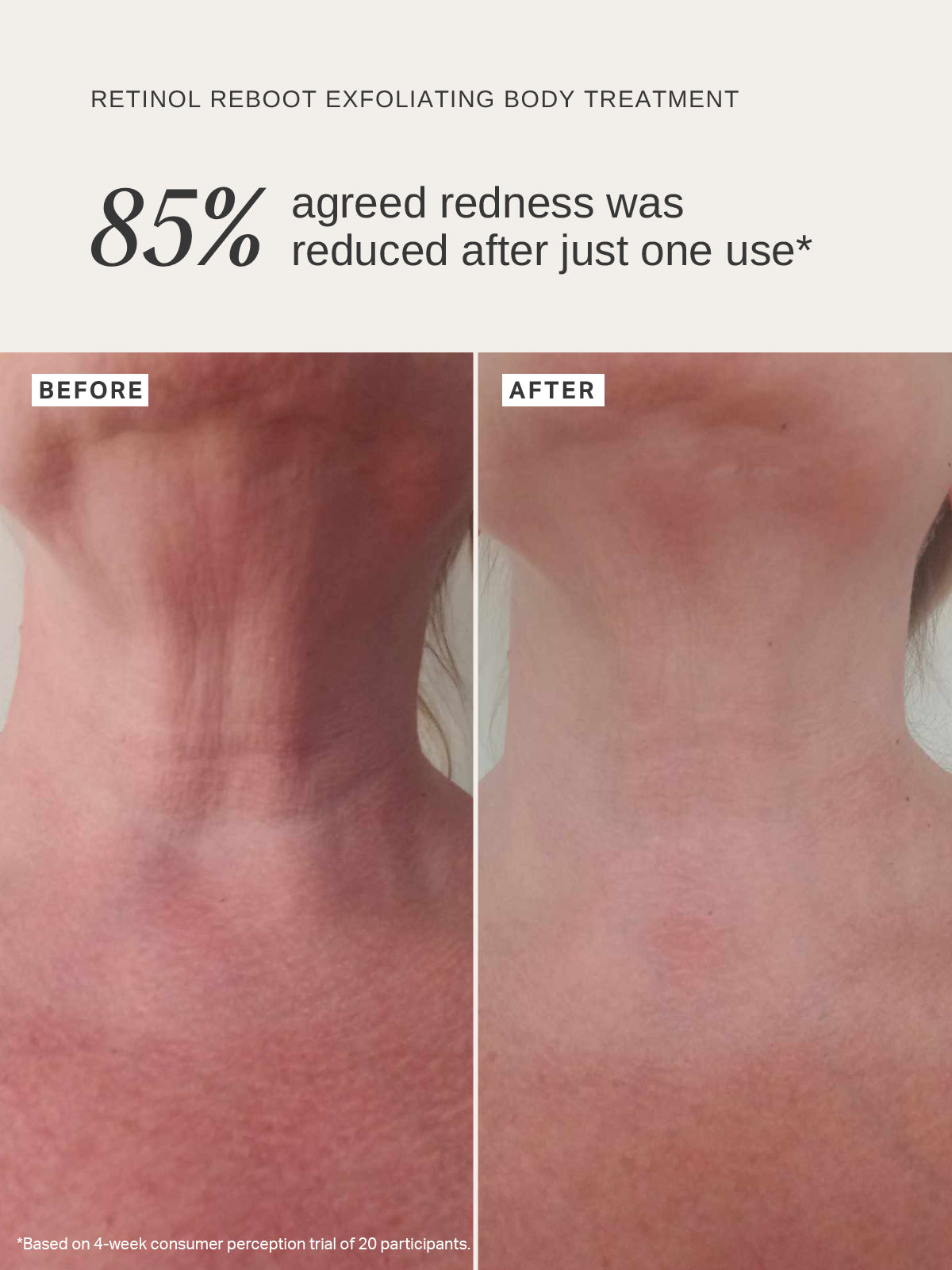 Retinol Reboot Exfoliating Body Treatment - Alpha-H Skincare Australia
