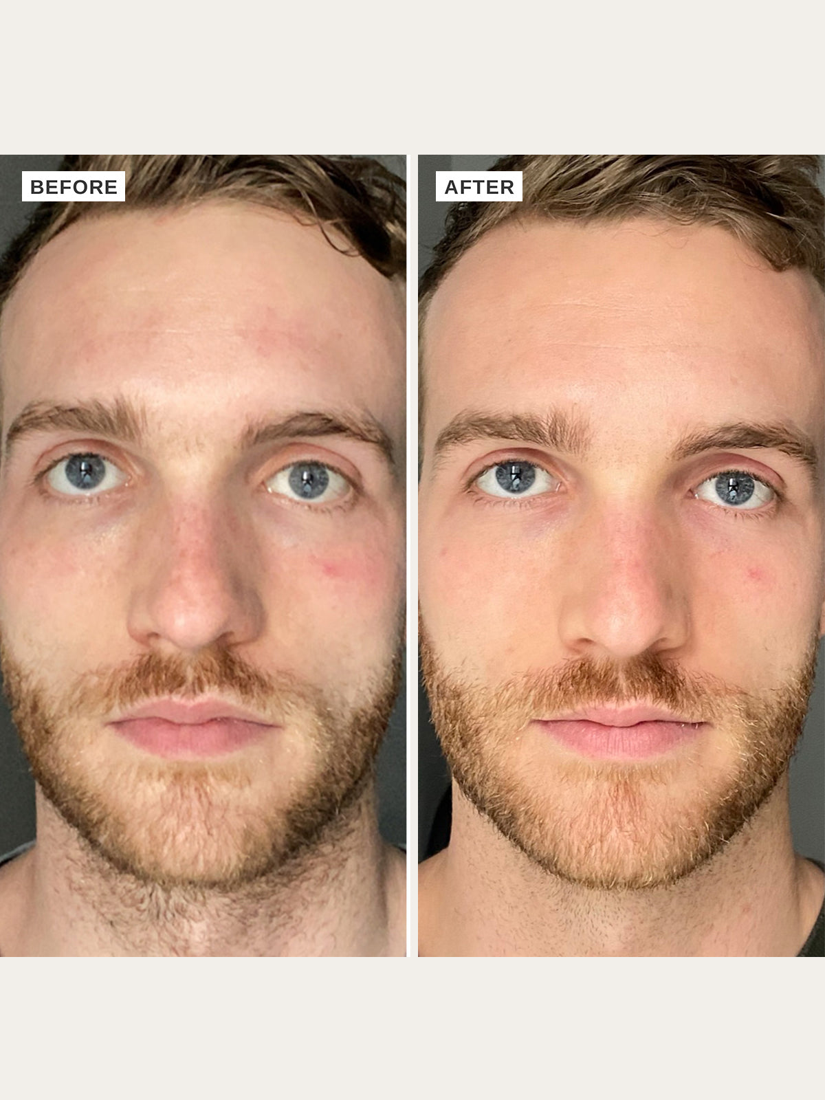 Vitamin B Serum with 5% Niacinamide - Alpha-H Skincare Australia