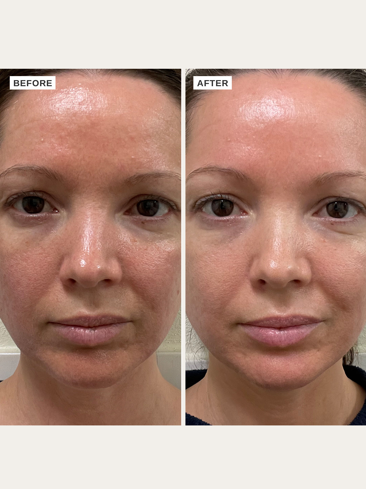 Vitamin B Serum with 5% Niacinamide - Alpha-H Skincare Australia