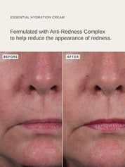 Essential Hydration Cream - Alpha-H Skincare Australia