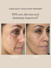 Liquid Gold 30ml - Alpha-H Skincare Australia