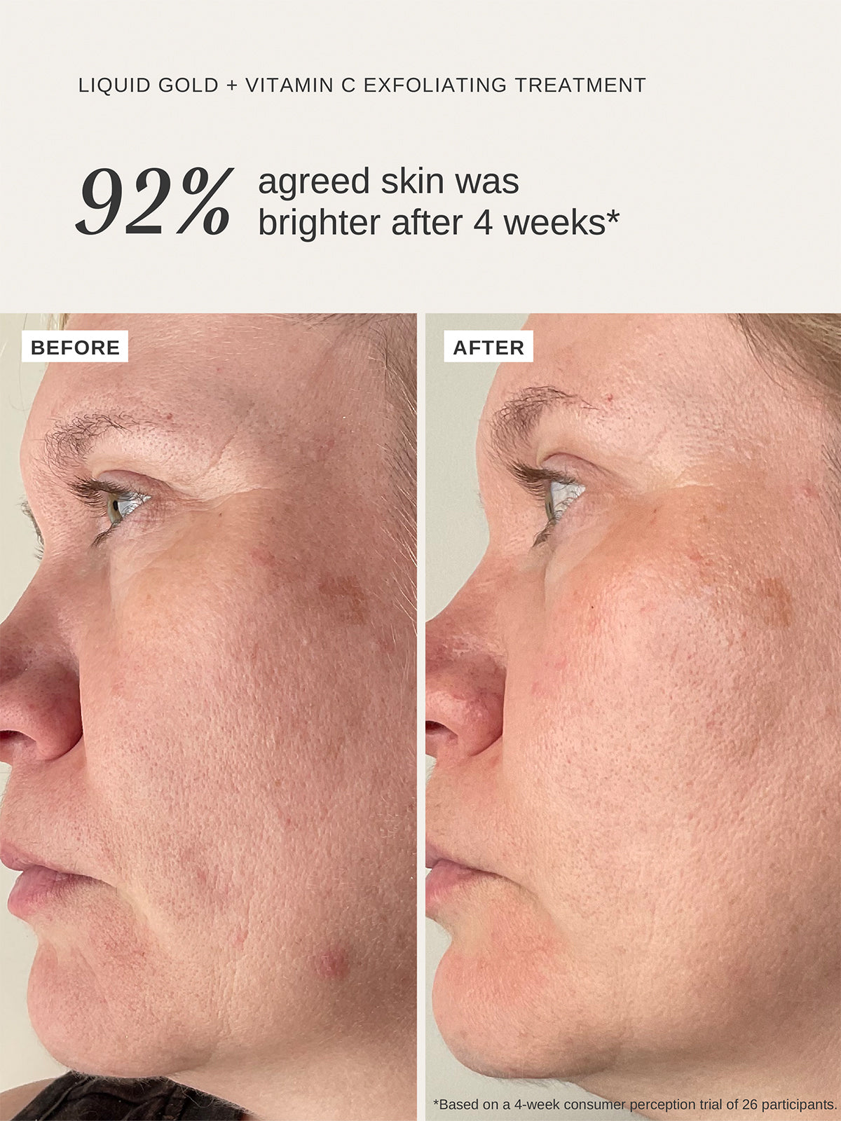 Vitamin C Duo - Alpha-H Skincare Australia
