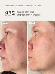 Vitamin C Duo - Alpha-H Skincare Australia
