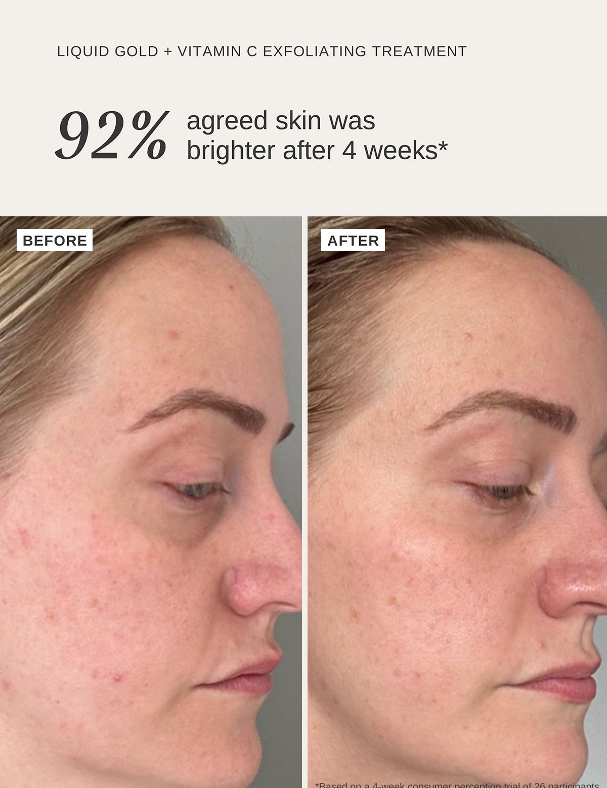 Liquid Gold + Vitamin C Trial Kit - Alpha-H Skincare Australia