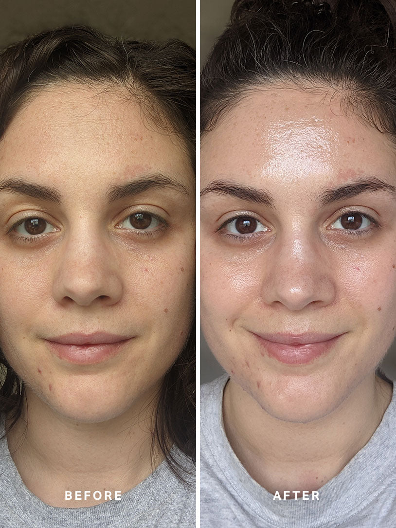 Liquid Gold 30ml - Alpha-H Skincare Australia