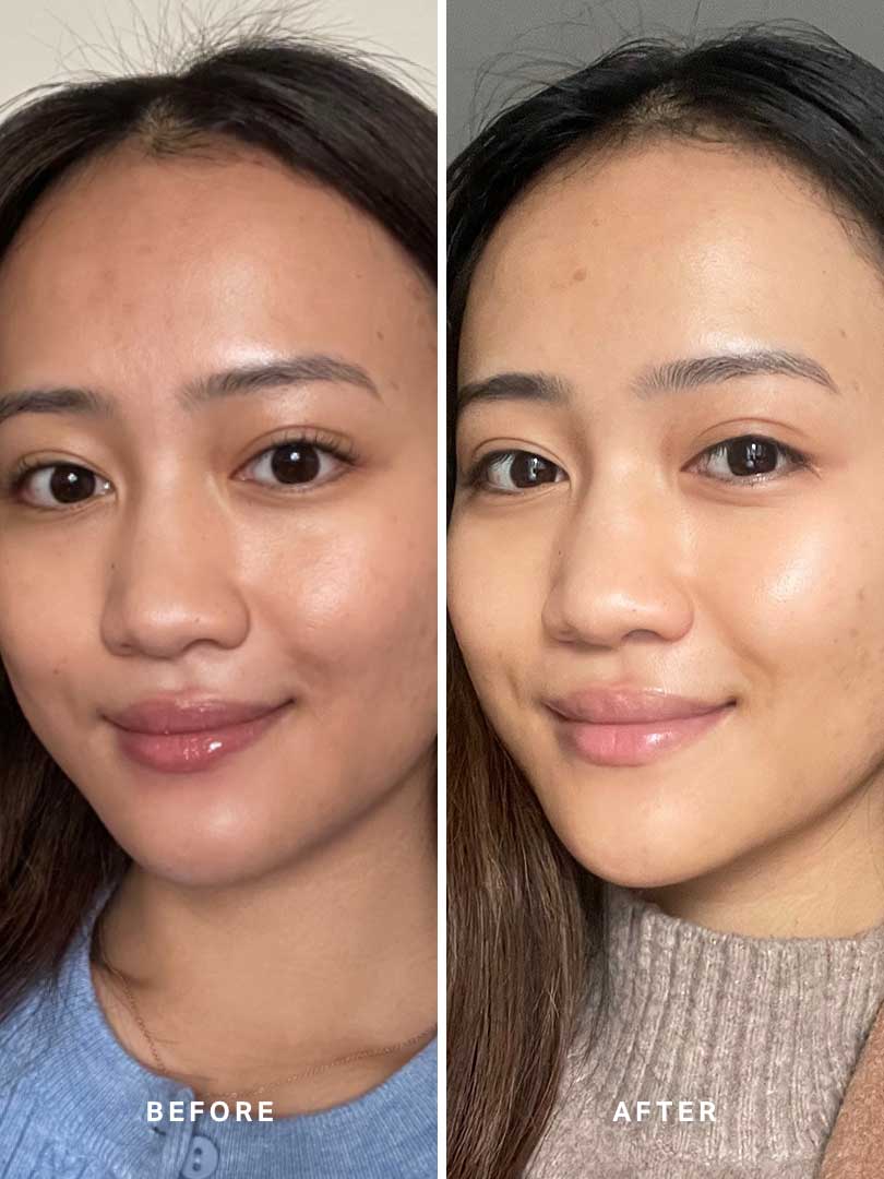 Liquid Gold 30ml - Alpha-H Skincare Australia