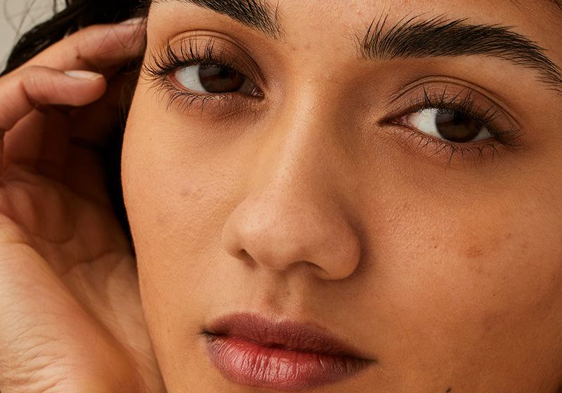 How to treat congested and breakout-prone skin