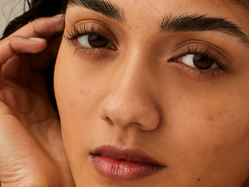 How to treat congested and breakout-prone skin