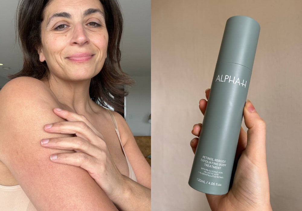 "It’s remarkable”: 6 people review our new Retinol and Glycolic Acid body treatment.