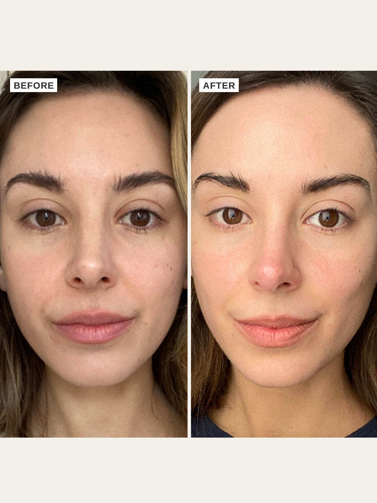 vitamin c serum on lips before and after Revitalize Your Lips: Turmeric & Brightening Lip Balm olivederived squalane Derma co Vitamin C Lip