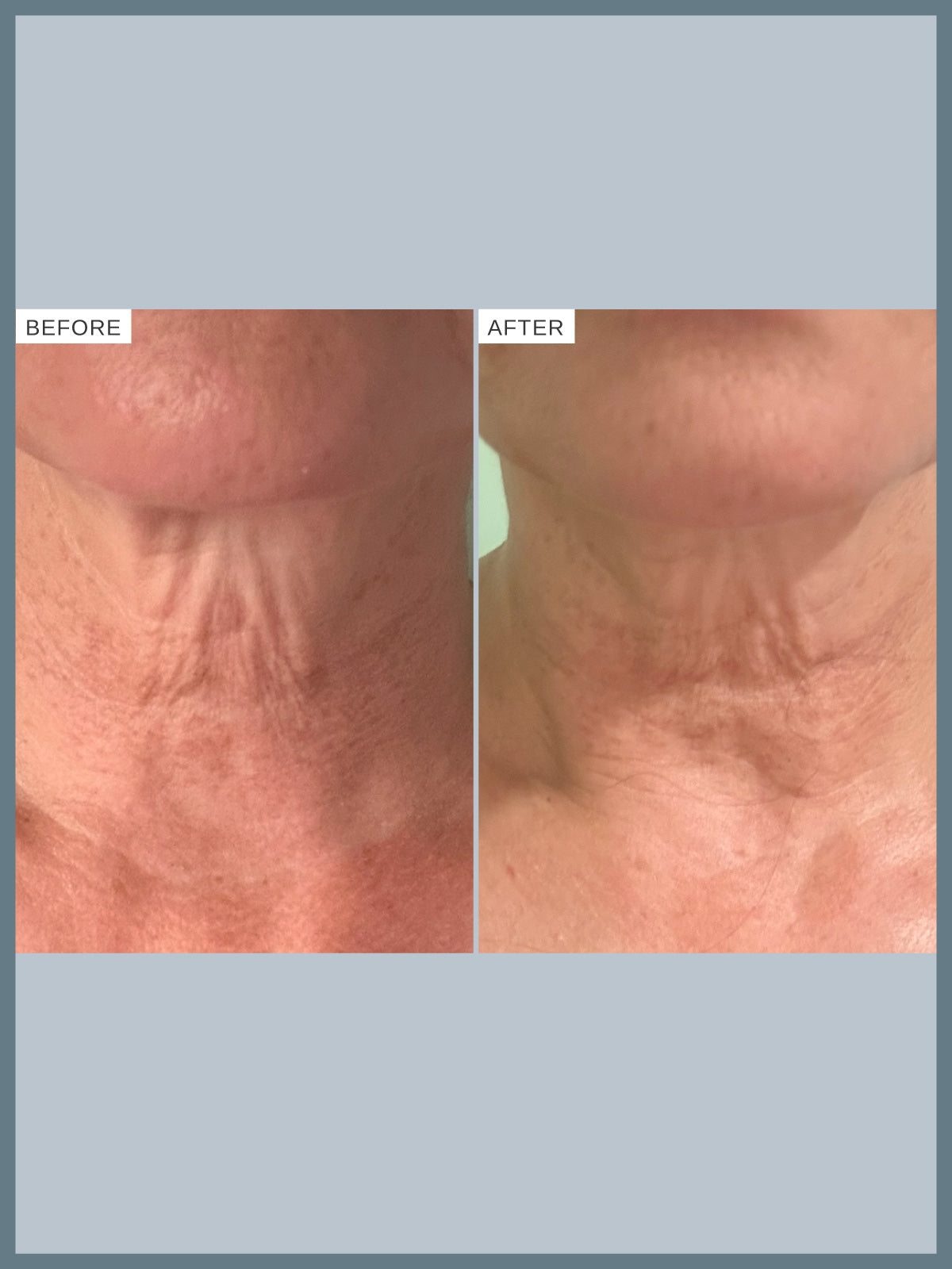 Firming Peptide Body Oil