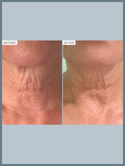 Firming Peptide Body Oil