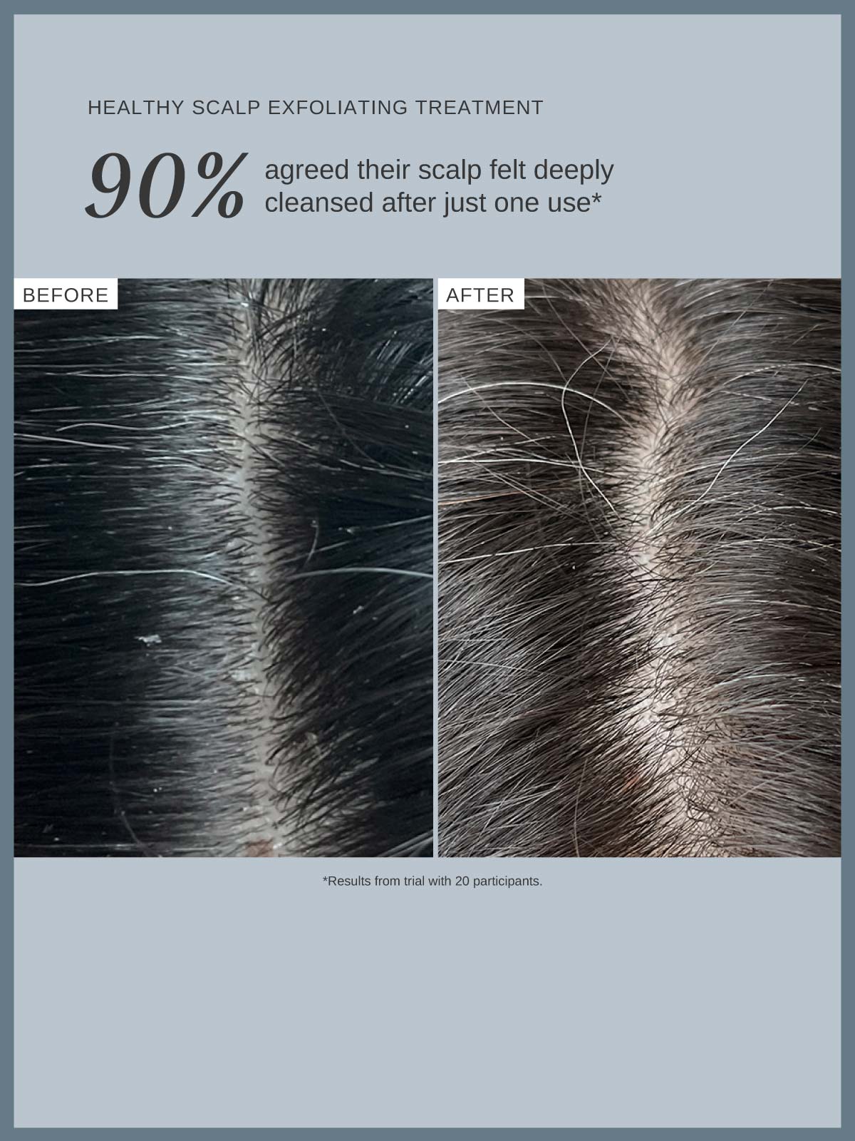 Healthy Scalp Exfoliating Treatment