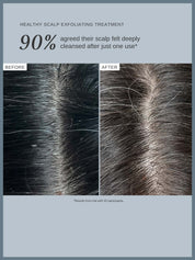 Healthy Scalp Exfoliating Treatment