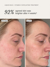 Pigmentation Face & Body Duo