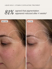 Liquid Gold + Vitamin C Trial Kit