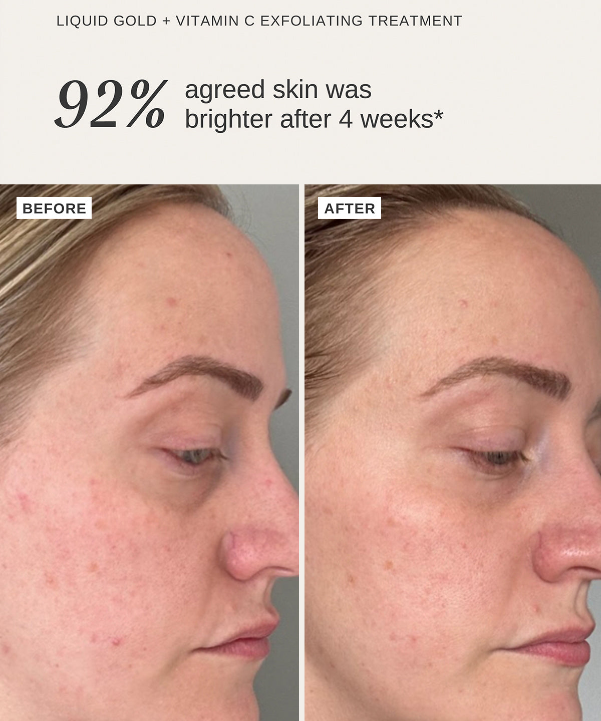 Liquid Gold + Vitamin C Trial Kit - Alpha-H Skincare Australia