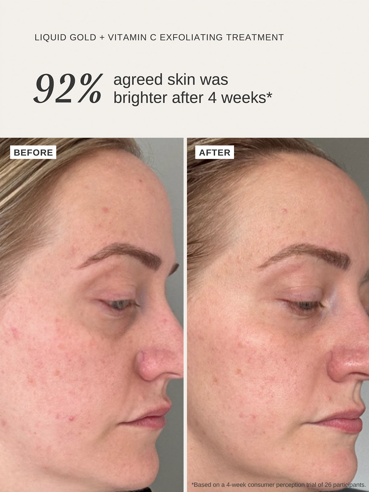 rho glutathione before and after Here's why I take every single day., I trust Nutrition because they make clean, safe products that actually work. , #RhoPartner | Jon "Bones" Jones ad When shopping for supplements,