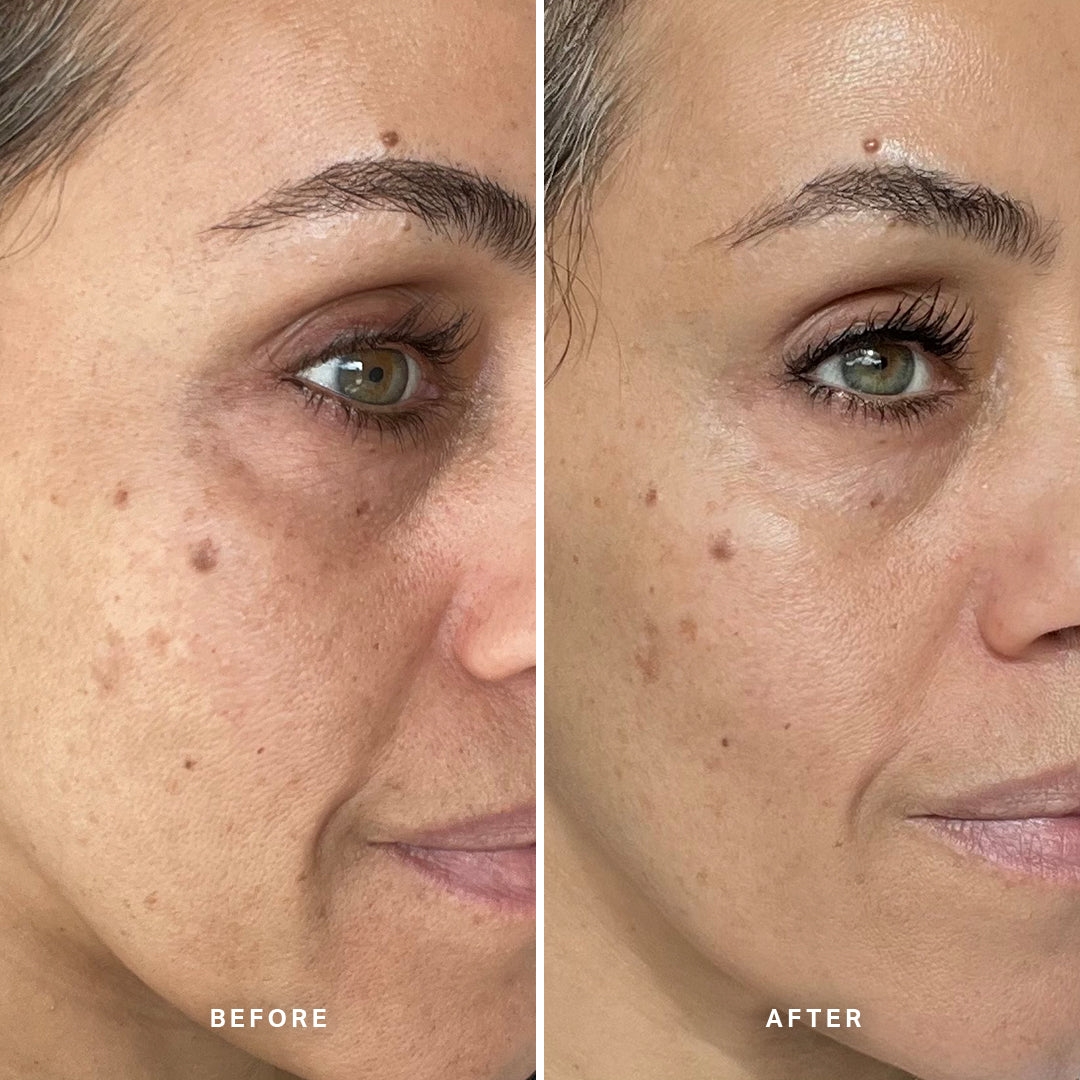 &quot;I&#39;ve been very impressed with the positive changes in my skin. It&#39;s actually quite unbelievable how smooth my skin is looking. My skin looked firmer and had a glow to it after 1 night.&quot;
