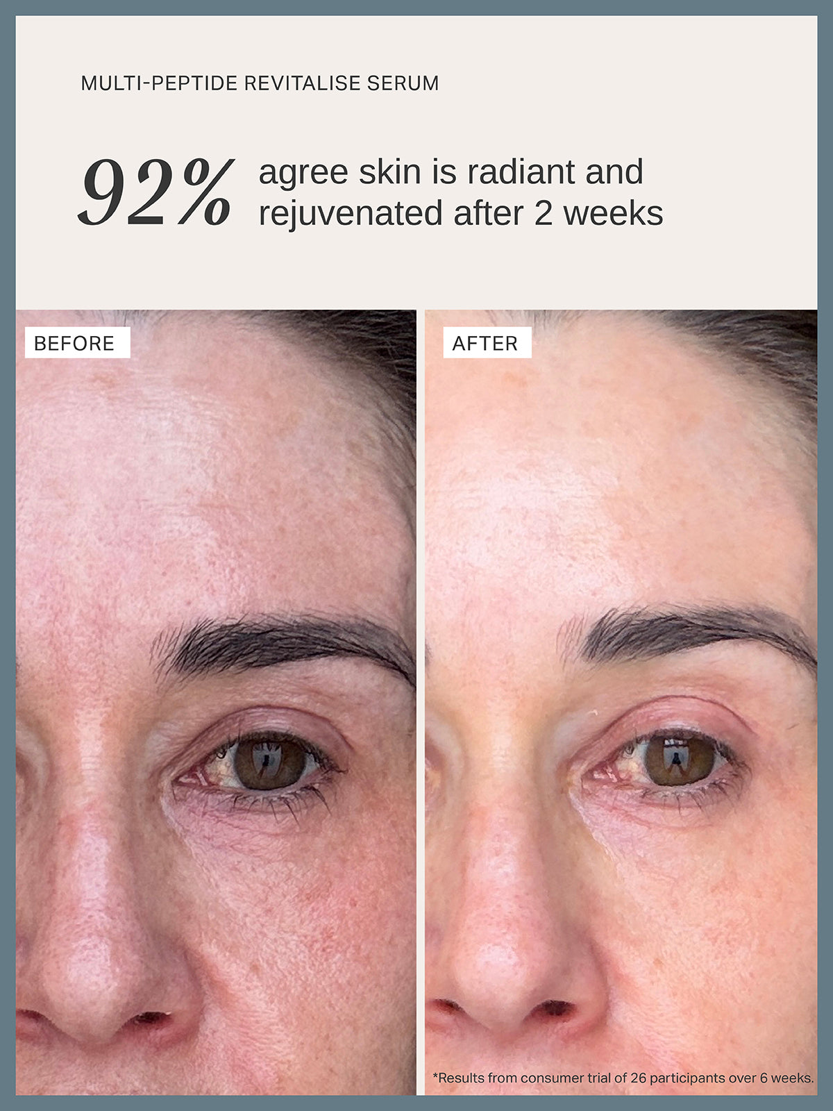 Multi-Peptide Revitalise Serum - Alpha-H Skincare Australia