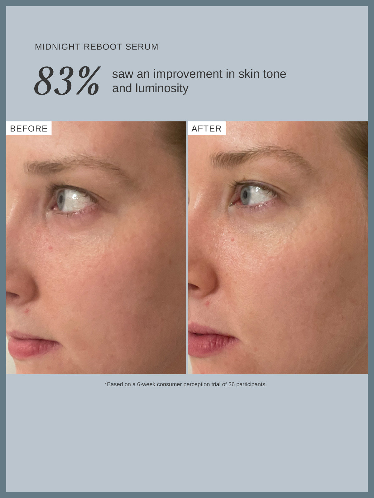 Midnight Reboot Serum
