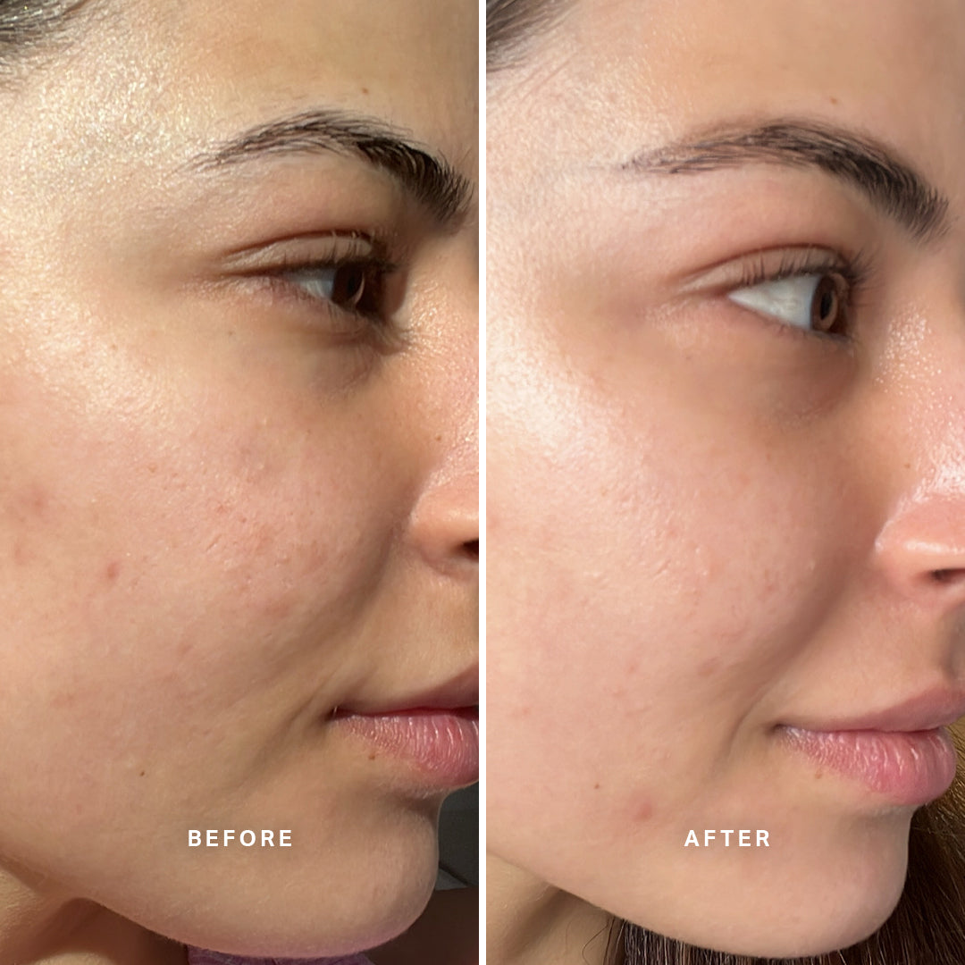 &quot;I didn&#39;t know my skin could look this smooth. When I woke up this morning, I saw the difference straight away. Liquid Gold has a spot in my routine forever.&quot;