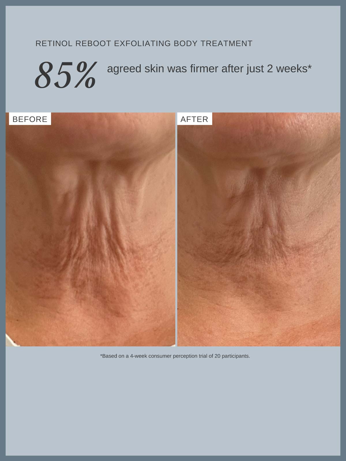 Retinol Reboot Exfoliating Body Treatment