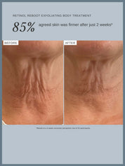 Retinol Reboot Exfoliating Body Treatment