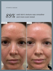 Vitamin B Serum with 5% Niacinamide