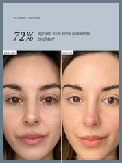 Vitamin C Serum with 10% Ethyl Ascorbic Acid