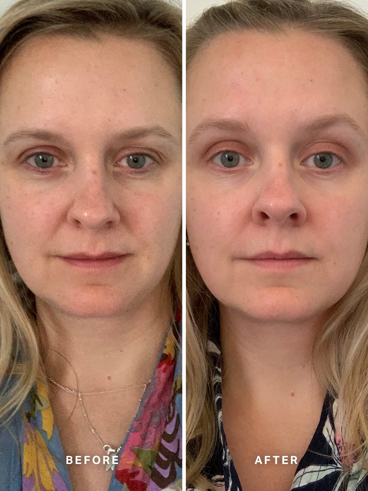Vitamin A Serum with 0.5% Retinol 15ml