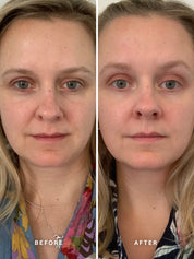 Vitamin A Serum with 0.5% Retinol 15ml